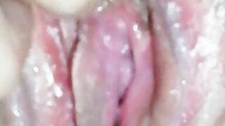 Hot weather what to do1