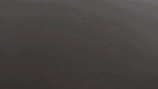 Step Mom vs Sunburn - Kat Marie - MomComesFirst - Alex Adams - 3 image